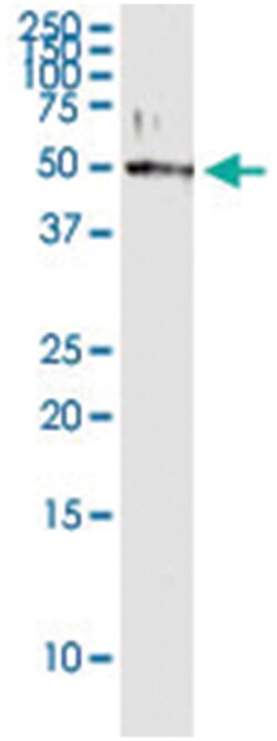 anti-KRT15, Human, IP-WB Antibody Pair, Abnova&trade;