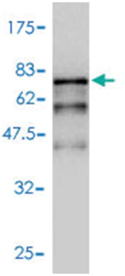 KRT18, Mouse, Polyclonal Antibody, Abnova 50&mu;L; Unlabeled:Antibodies,