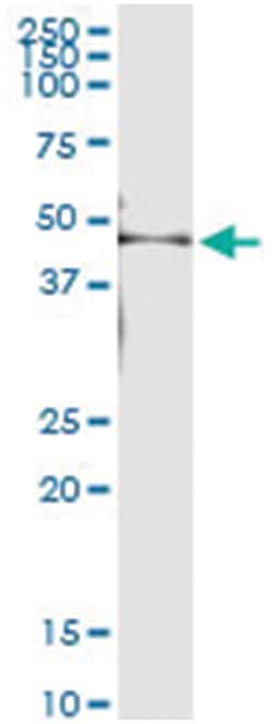 anti-KRT35, Human, IP-WB Antibody Pair, Abnova&trade;