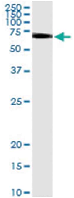 anti-KRT83, Human, IP-WB Antibody Pair, Abnova™