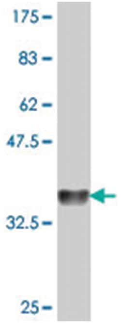 LALBA, Mouse, Polyclonal Antibody, Abnova 50 &mu;L | Buy Online | Abnova Corporation | Fisher Scientific