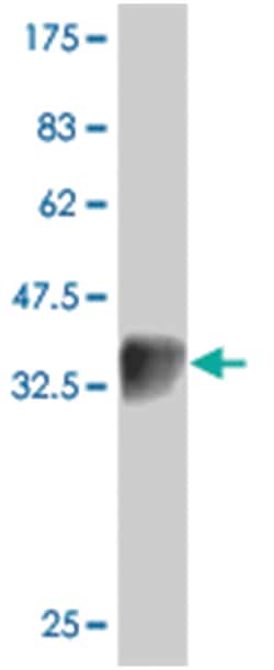 LAMP2, Mouse, Polyclonal Antibody, Abnova 50&mu;L; Unlabeled:Antibodies,