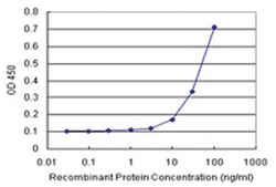 anti-LCK Matched Antibody Pair, Abnova 1 Set:Antibodies, Monoclonal/Polyclonal