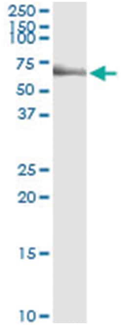 Abnova anti-LCK, Human, IP-WB Antibody Pair, Abnova™