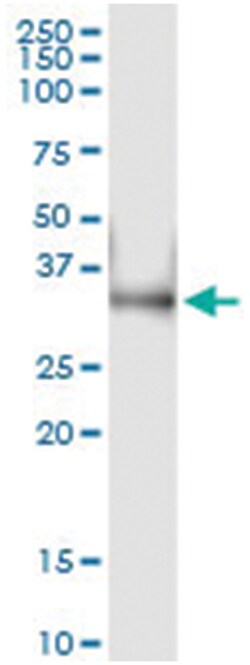 anti-LDHA, Human, IP-WB Antibody Pair, Abnova&trade;