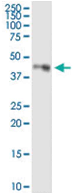 anti-LDHC, Human, IP-WB Antibody Pair, Abnova™