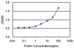 anti-LGALS1 Matched Antibody Pair, Abnova&trade;