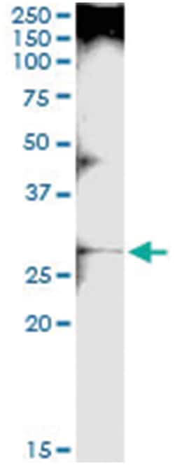 anti-LGALS3, Human, IP-WB Antibody Pair, Abnova™