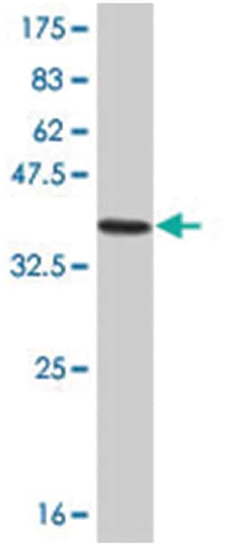 LIM homeobox 1, Mouse, Clone: 3G3, Abnova&trade;