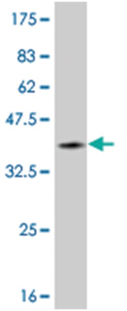 LHX1, Mouse, Clone: 2G5, Abnova 100 &mu;g | Buy Online | Abnova Corporation | Fisher Scientific