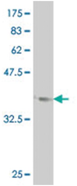 LHX1, Mouse, Clone: 1C11, Abnova 100 &mu;g | Buy Online | Abnova Corporation | Fisher Scientific
