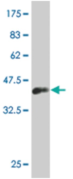 LHX1, Mouse, Clone: 2A7, Abnova 100 &mu;g | Buy Online | Abnova Corporation | Fisher Scientific