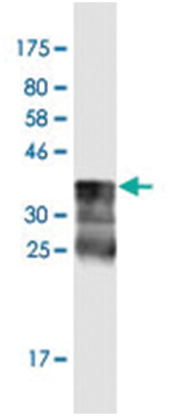 ABLIM1, Mouse, Clone: 3A1, Abnova 200&mu;L; Unlabeled:Antibodies, Monoclonal