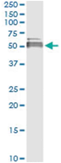 anti-LIPA, Human, IP-WB Antibody Pair, Abnova 1 Set:Antibodies, Monoclonal/Polyclonal