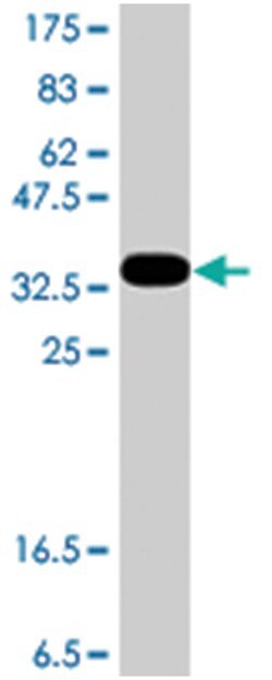LLGL2, Mouse, Polyclonal Antibody, Abnova 50 &mu;L | Buy Online | Abnova Corporation | Fisher Scientific