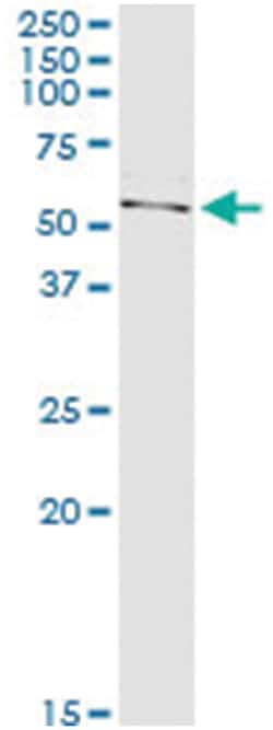 anti-LMNA, Human, IP-WB Antibody Pair, Abnova&trade;