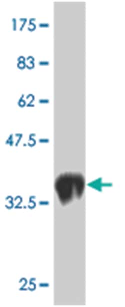 LIM domain only 1 (rhombotin 1), Mouse, Clone: 1A9, Abnova&trade;