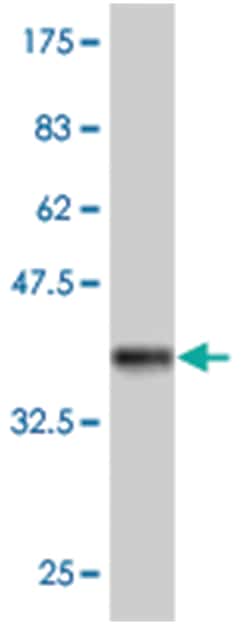 LNPEP, Mouse, Polyclonal Antibody, Abnova 50μL; Unlabeled:Antibodies,
