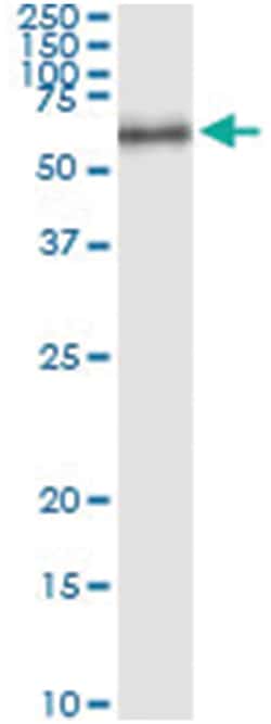 anti-LPL, Human, IP-WB Antibody Pair, Abnova&trade;