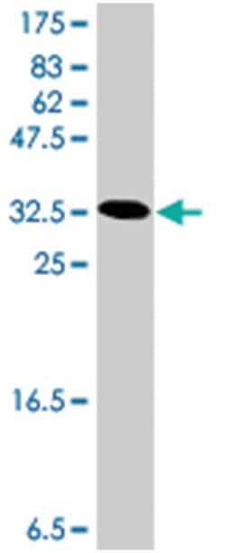 LRP5, Mouse, Polyclonal Antibody, Abnova 50&mu;L; Unlabeled:Antibodies,