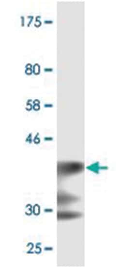LRP5, Mouse, Clone: 1E9, Abnova 200&mu;L; Unlabeled:Antibodies, Monoclonal