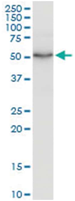 anti-LSP1, Human, IP-WB Antibody Pair, Abnova 1 Set:Antibodies, Monoclonal/Polyclonal