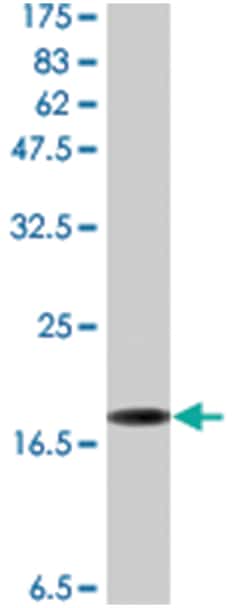 anti-LTA, Flag/His, Clone: 1B8, Abnova 100 &mu;g | Buy Online | Abnova Corporation | Fisher Scientific