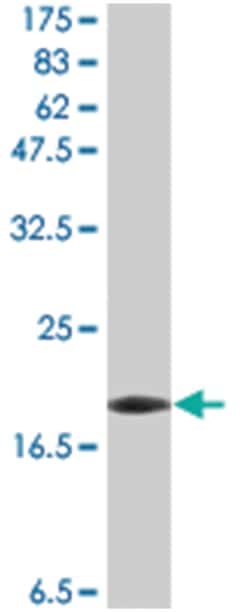 anti-LTA, Flag/His, Clone: 3B5, Abnova 100&mu;g, Flag/His:Antibodies, Monoclonal
