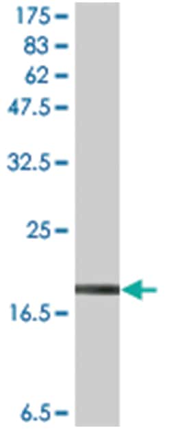 anti-LTA, Flag/His, Clone: 2H8, Abnova 100&mu;g, Flag/His:Antibodies, Monoclonal
