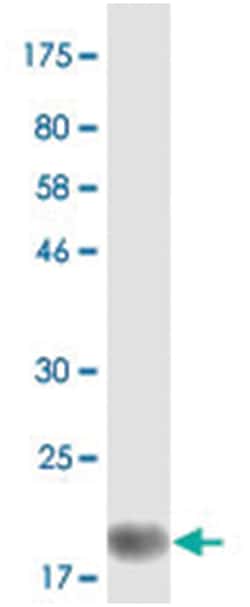 anti-LTA, Flag/His, Clone: 2A8, Abnova 100&mu;g, Flag/His:Anticuerpos