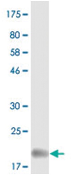 anti-LTA, Flag/His, Clone: 2F1, Abnova 100 &mu;g | Buy Online | Abnova Corporation | Fisher Scientific