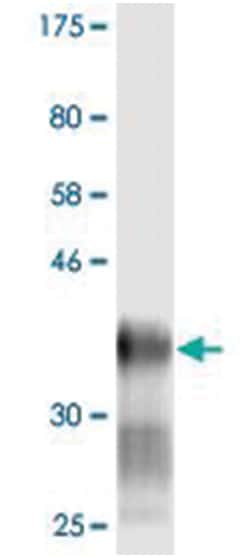 LY6H, Mouse, Clone: 1D1, Abnova 100 &mu;g | Buy Online | Abnova Corporation | Fisher Scientific
