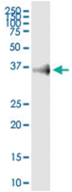 anti-EPCAM, Human, IP-WB Antibody Pair, Abnova 1 Set:Antibodies, Monoclonal/Polyclonal