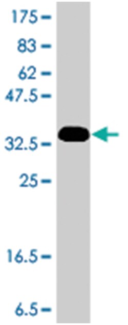 NBR1, Mouse, Polyclonal Antibody, Abnova 50 &mu;L | Buy Online | Abnova Corporation | Fisher Scientific