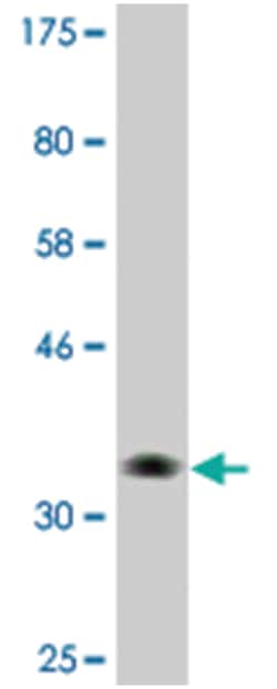 NBR1, Mouse, Clone: 3D3, Abnova 200&mu;L; Unlabeled:Antibodies, Monoclonal