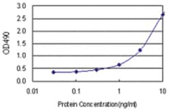anti-MAGEA4 Ab-1 Matched Antibody Pair, Abnova 1 Set; Unlabeled:Antibodies,