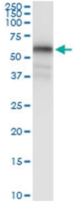anti-MAGEA8, Human, IP-WB Antibody Pair, Abnova&trade;