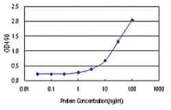 anti-MAGEA9 Ab-1 Matched Antibody Pair, Abnova&trade;