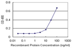 anti-MAGEA9 Ab-2 Matched Antibody Pair, Abnova™