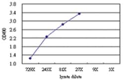 anti-MAGEA9 Ab-3 Matched Antibody Pair, Abnova&trade;