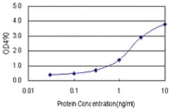 anti-MAGEA11 Matched Antibody Pair, Abnova&trade;