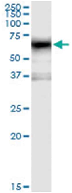 anti-MAOA, Human, IP-WB Antibody Pair, Abnova 1 Set:Antibodies, Monoclonal/Polyclonal