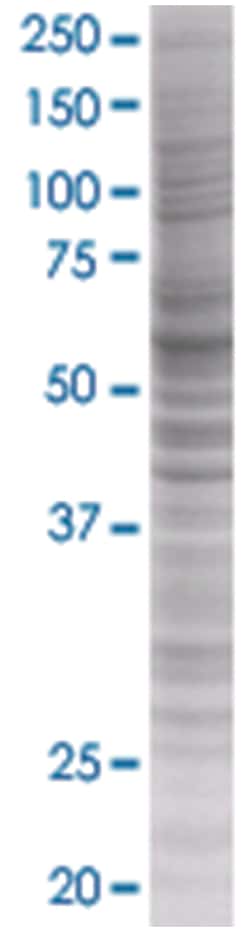 MAOA 293T Cell Overexpression Lysate (Denatured), Abnova