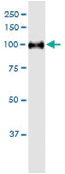 anti-MARS, Human, IP-WB Antibody Pair, Abnova™