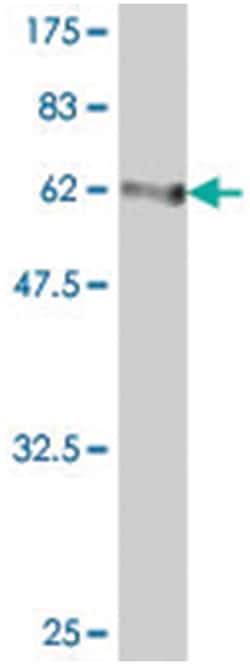 MBNL1, Mouse, Polyclonal Antibody, Abnova 50&mu;L; Unlabeled:Antibodies,