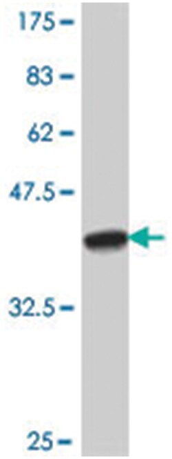 myeloid cell leukemia sequence 1 (BCL2-related), Mouse, Polyclonal Antibody,