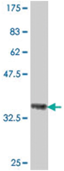 MCM2, Mouse, Polyclonal Antibody, Abnova 50&mu;L; Unlabeled:Antibodies,