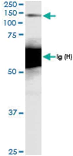 MCM2, Human, IP-WB Antibody Pair (PW1), Abnova 1 Set:Antibodies, Monoclonal/Polyclonal