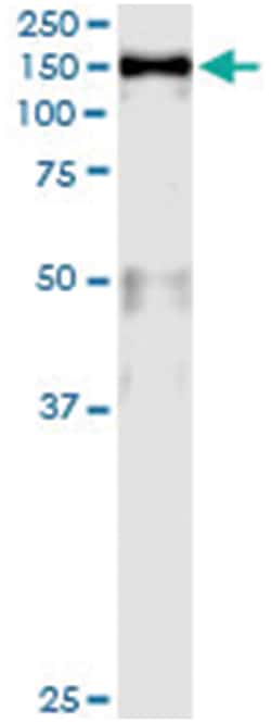 MCM2, Human, IP-WB Antibody Pair (PW2), Abnova&trade;
