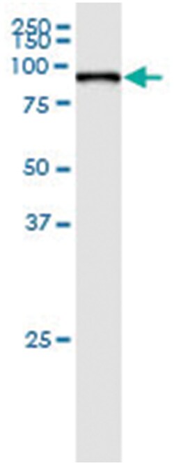 anti-MCM7, Human, IP-WB Antibody Pair, Abnova 1 Set | Buy Online | Abnova | Fisher Scientific